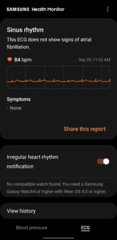 Download ECG Data